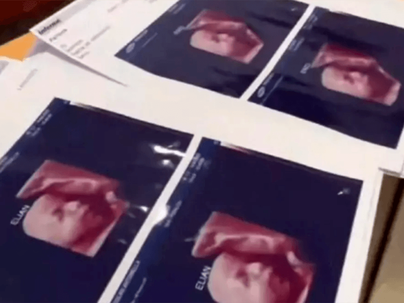 Clinica entrega mismo ultrasonido a embarazadas