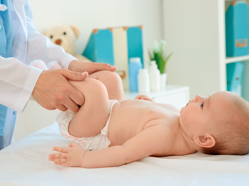 Hernia inguinal en el bebé: lo que debes saber