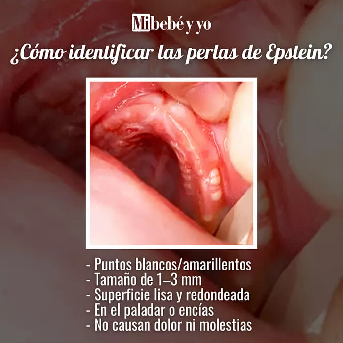 perlas-epstein-caracteristicas-infografia
