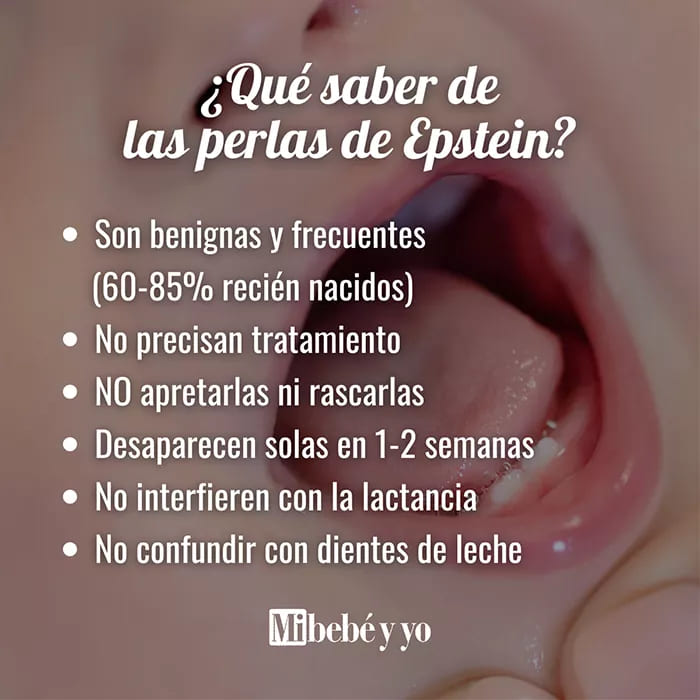 perlas-epstein-infografia