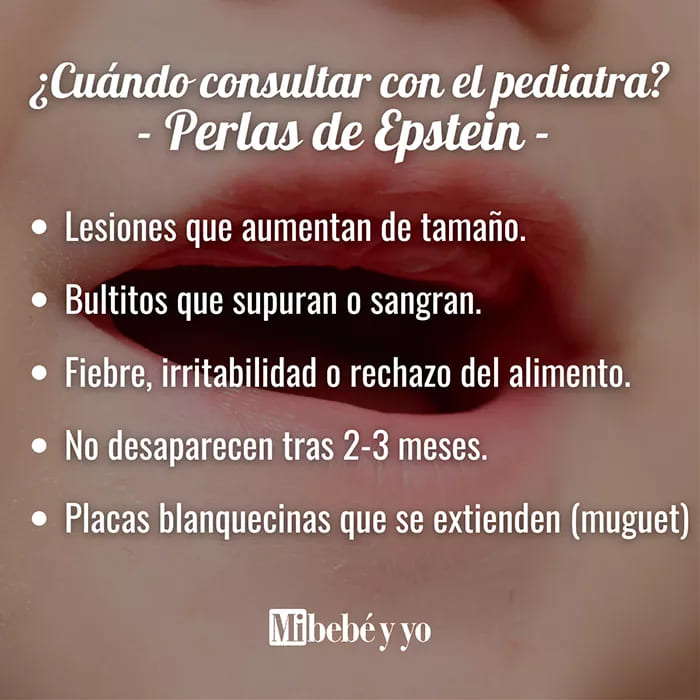 perlas-epstein-signos-alarma-infografia