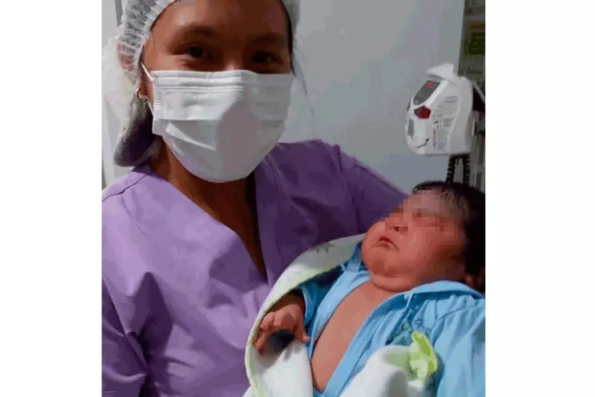 bebe-7-kilos-bolivia