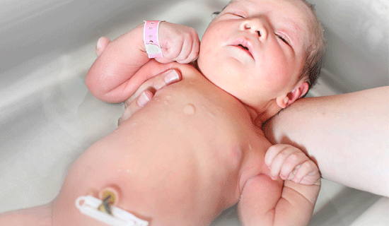 cordon umbilical bano bebe