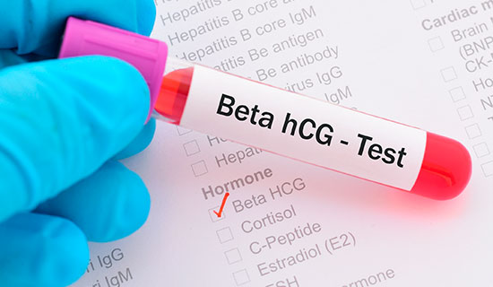 beta hcg test