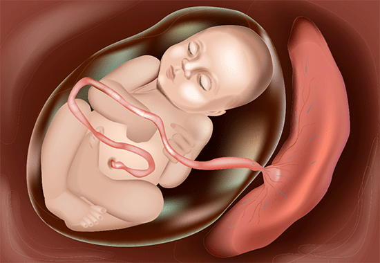 placenta normoinserta infografia