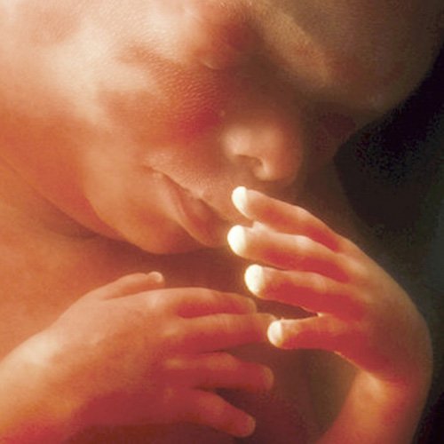 Semana 20 de embarazo: ¡Toca la ecografía más importante!
