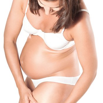 Las varices en el embarazo