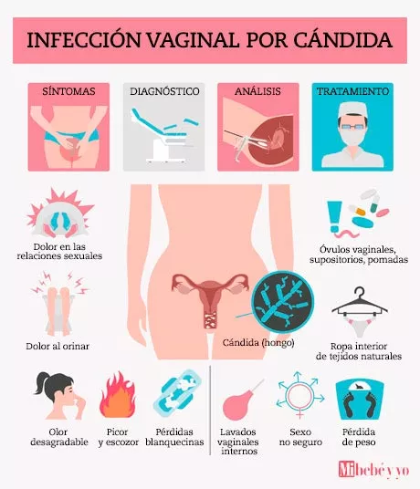 Infografía candidiasis embarazo