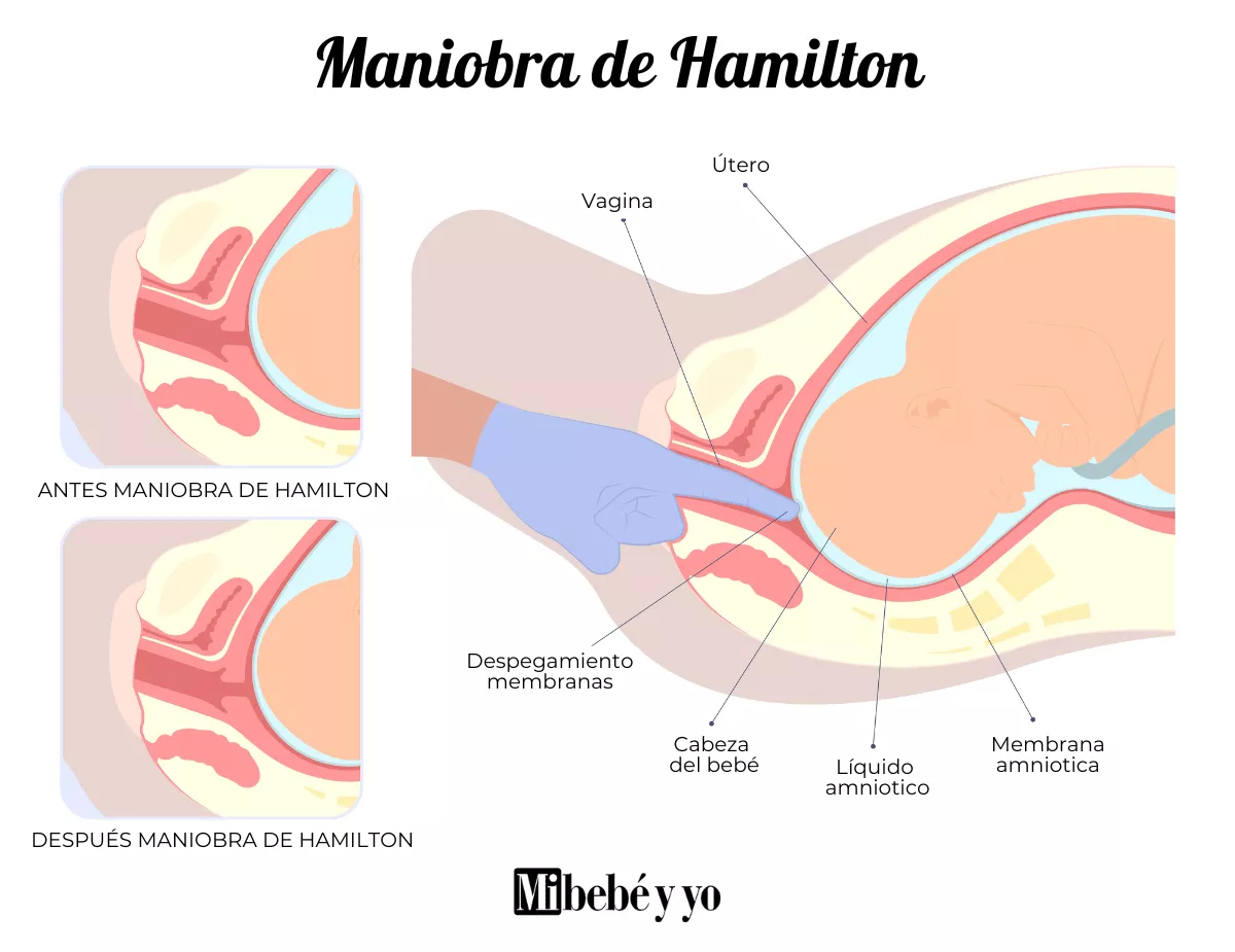 maniobra_hamilton_infografia