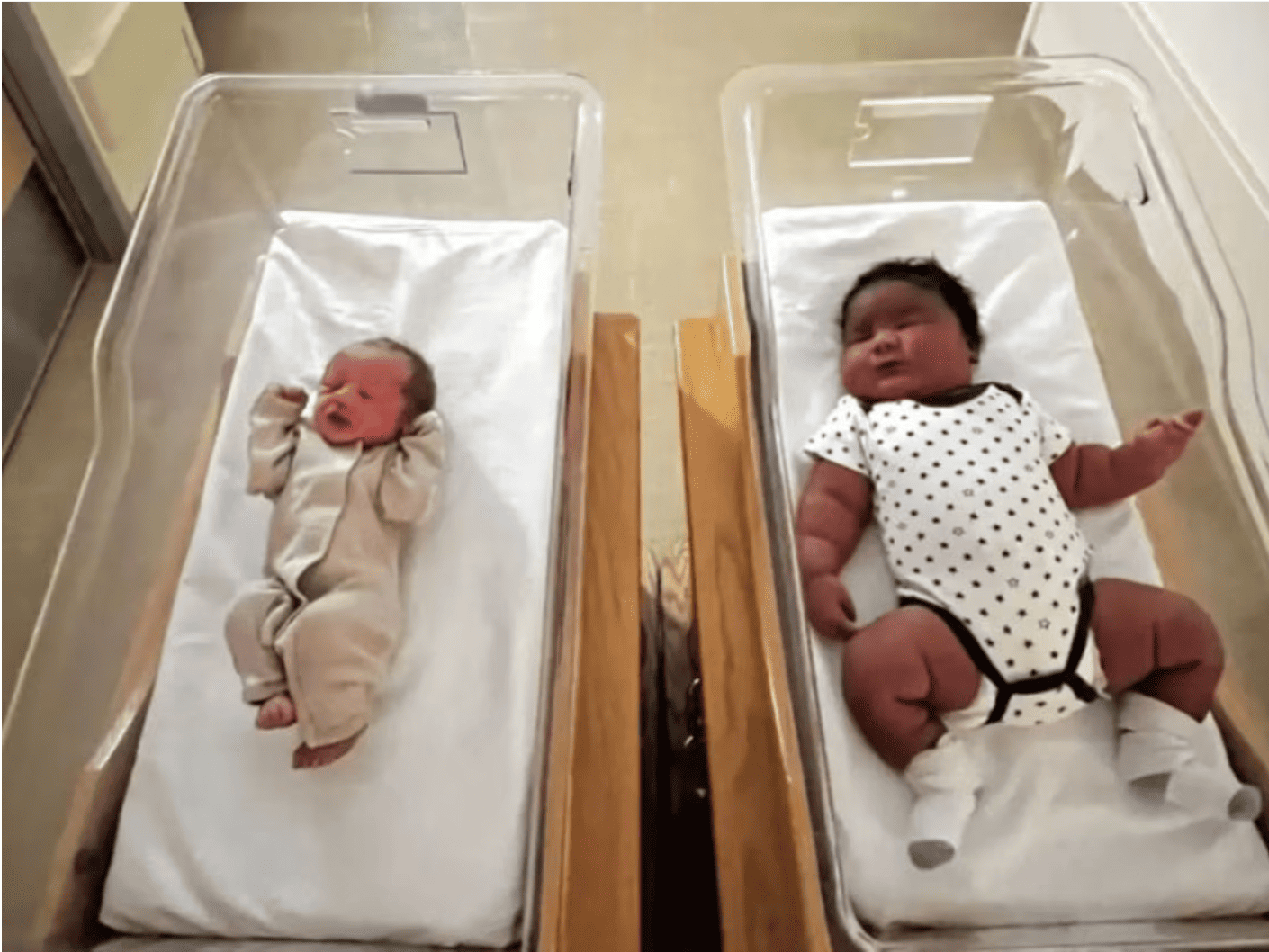 Dos bebés, el mismo día, tamaños opuestos: la historia que está dando la vuelta al mundo bebés tamaños opuestos