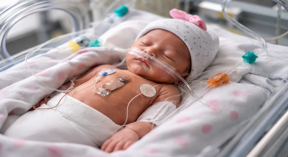 Bebé recién nacida recibe el marcapasos más pequeño del mundo y logra salir adelante marcapasos recien nacida