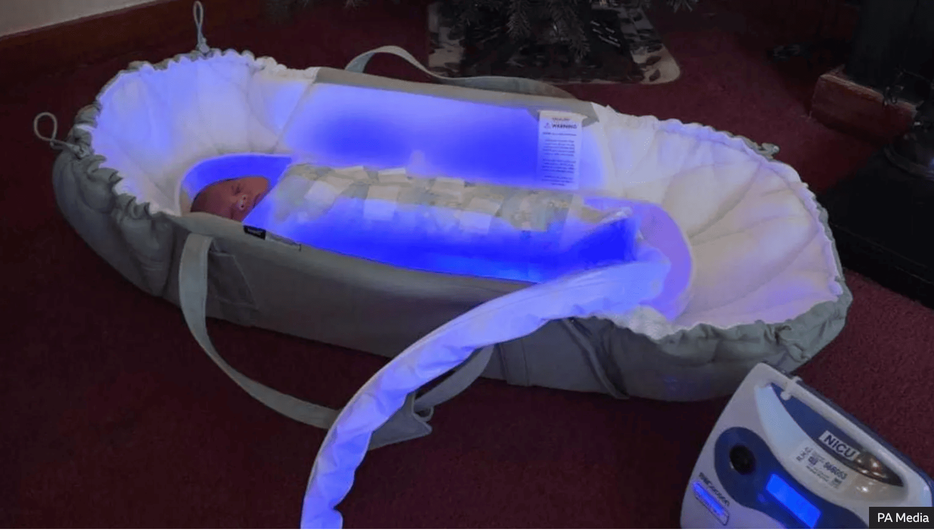 Unos sacos de dormir especiales permiten tratar en casa a los bebés con ictericia sacos ictericia bebes