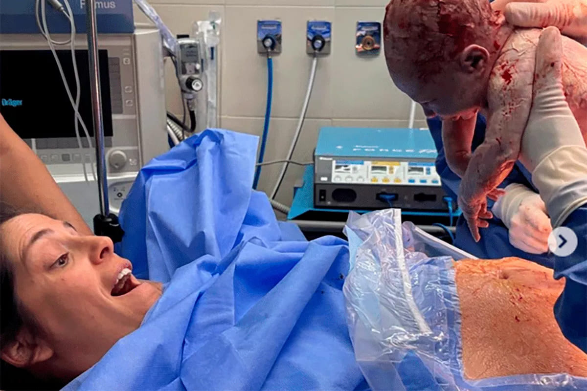 video cesarea respetada