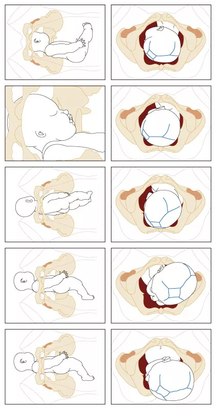 nacimiento-pelvis-infografia