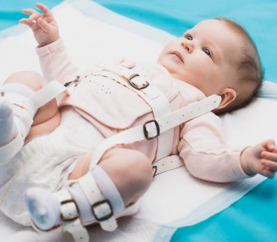 A,Baby,Wearing,A,Harness,That,Corrects,Hip,Dysplasia